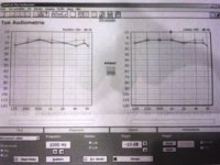 Audiogram_Pulsating 0-8kHz AcquaKlinik 18MAR2014.jpg