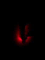 LLLT_Ear 80mW Laser (Dark).jpg