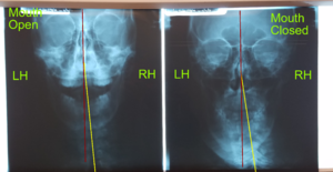 xray_front.png