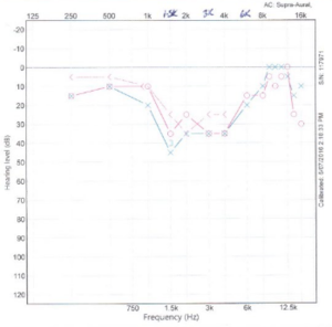 Audiogram 03Apr.png