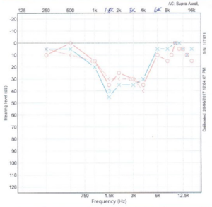 Audiogram 28Jul.png