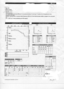 Ear Test Aug 1 2017 For Online.jpg