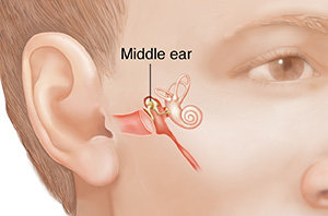 middle-ear-1.jpg