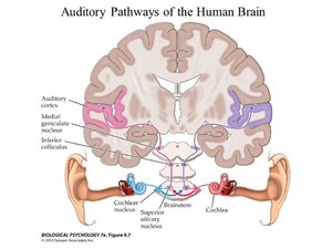 Auditory+Pathways+of+the+Human+Brain.jpg