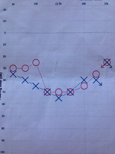 Høyfrekvenz Audiogram.jpg