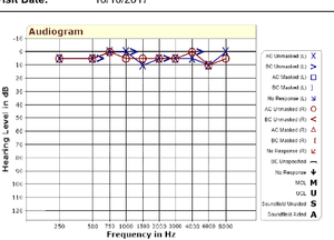 AUDIOGRAM OCT.png