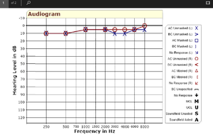 AUDIOGRAM EARLY 2018.png