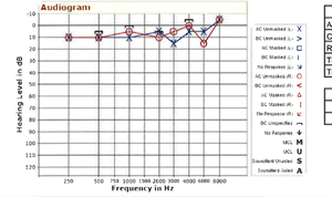 AUDIOGRAM SEPTEBER 2018.png