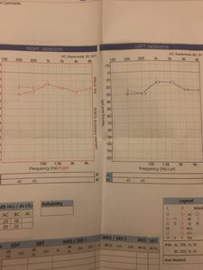 1-audiogram.jpg