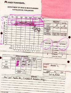 Audiogram.jpeg