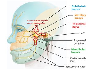 trigeminal-nerve.jpg