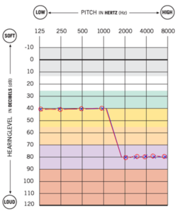 hearing-profile.png