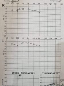 Hearing test.jpeg