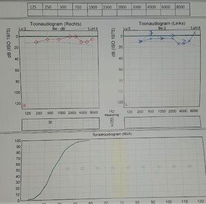 audiogram.jpeg