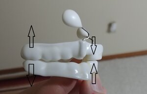 TMJ Nighttime Orthotic.jpg