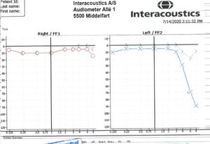 audiogram.jpg