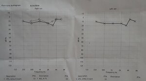 audiogram.JPG