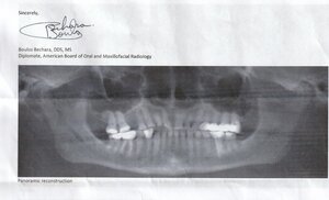 CBCT2.jpg