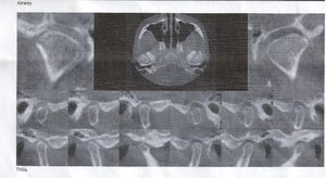 CBCT3.jpg