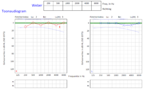 Audiogram.PNG