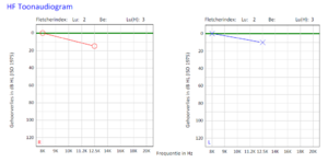 HF audiogram.PNG