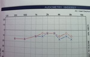 Audiogram March 2021.jpg